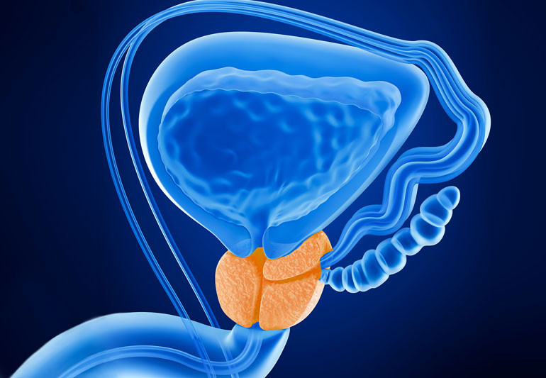 Prostate 588242562 770x533 1